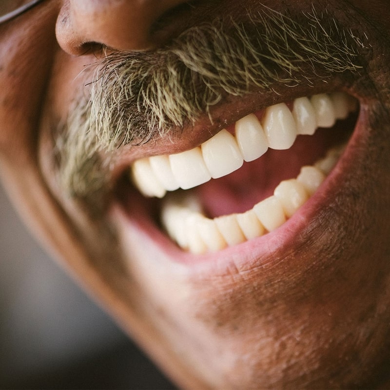 Patient Gallery Todd Whitlock Dentistry in Bloomington, IN