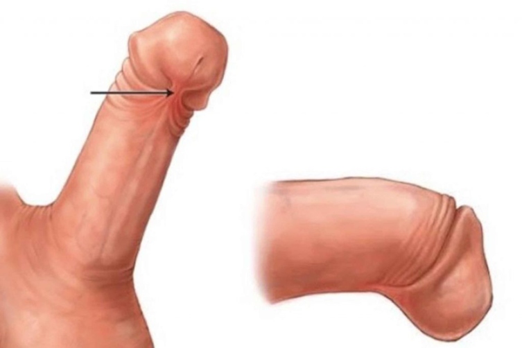 Anderes wort für penis