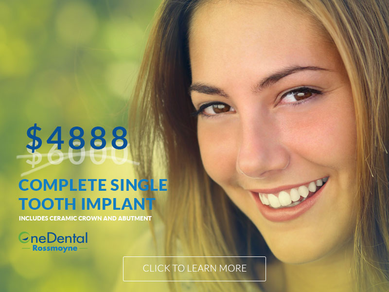 Book Online Dental Appointments One Dental Rossmoyne
