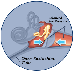 Relief of Pressure Buildup, Eustachian Tube Dysfunction