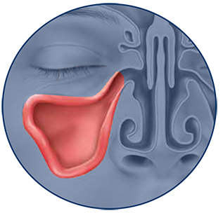 Sinus relief