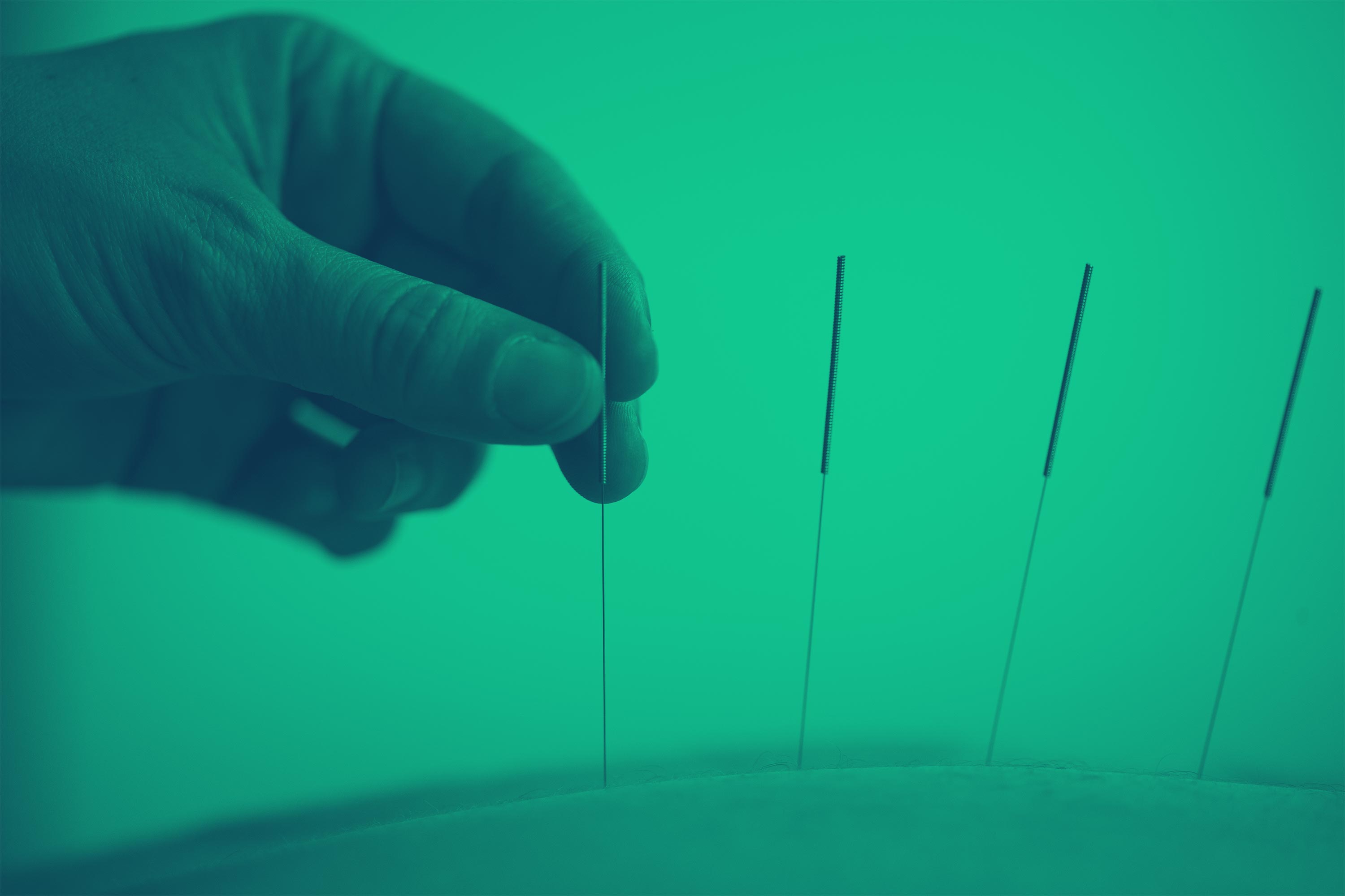 Acupuncture Clinique O point LeMoyne