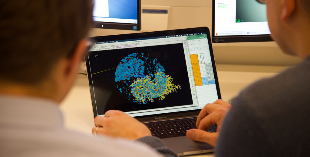 All data collected by the researchers during the experiment at MAX IV is converted into a three-dimensional structure in which the researchers can see the atoms in detail and understand different parts of the protein. The most interesting aspect is what is known as the "active site” – where the chemical reaction takes place. By designing molecules, or inhibitors, the researchers hope to be able to prevent the enzyme's function. (Photo: Tove Smeds)