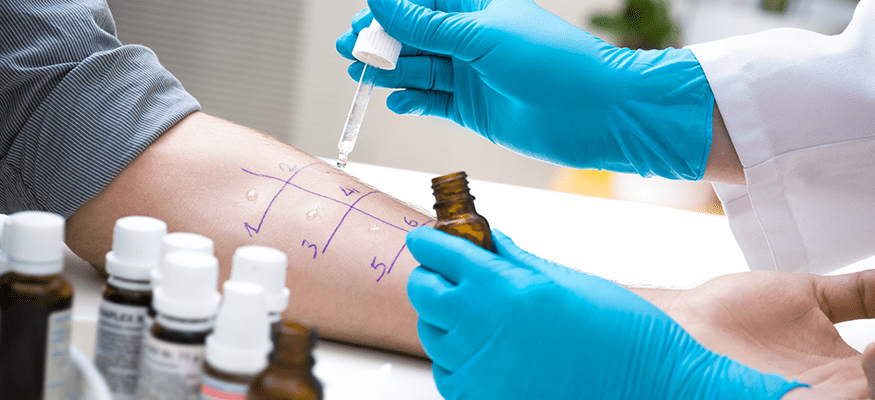 Skin prick test at Cumberland Valley ENT