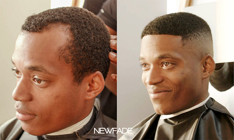 NewFade before and after