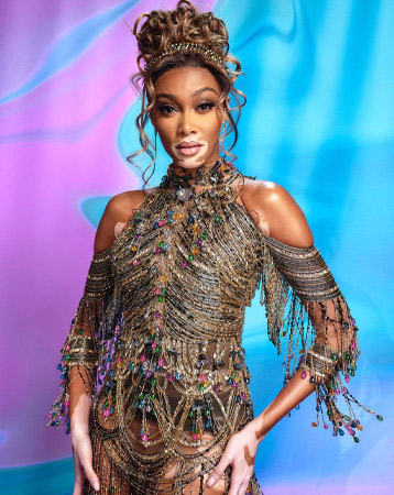Winnie Harlow