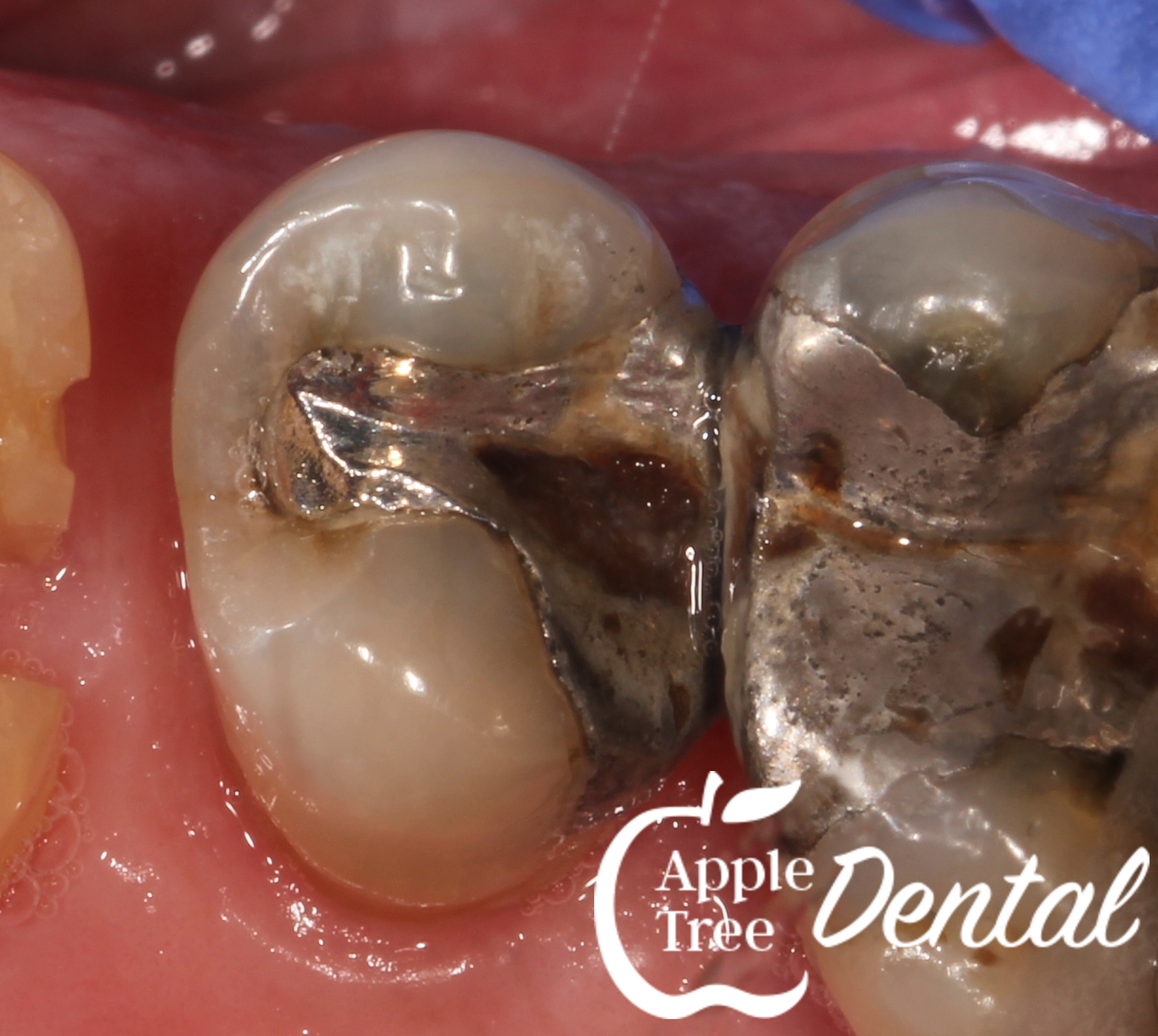 What is the blue light all about? Blog