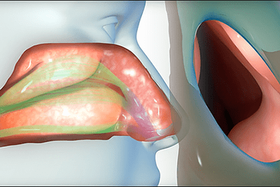 Nasal Obstruction Problems