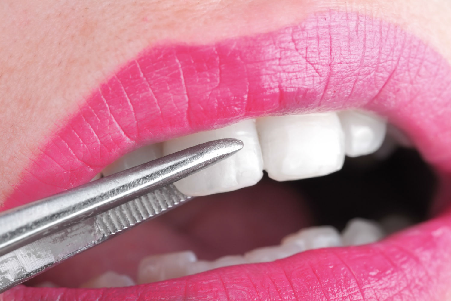 Blog Pinnacle Family Dental Ellicott City, MD