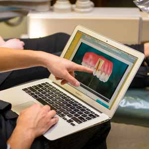 digital image of dental crown