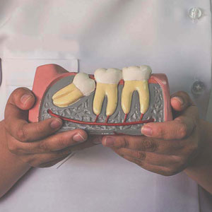 hawthorn dentist holding model of crooked teeth