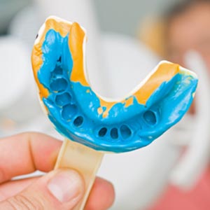 dental bridge mold