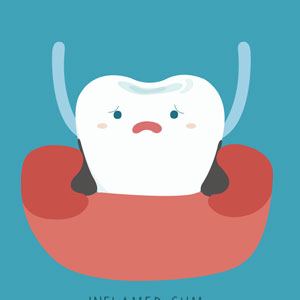 bleeding gums due to poor oral hygiene