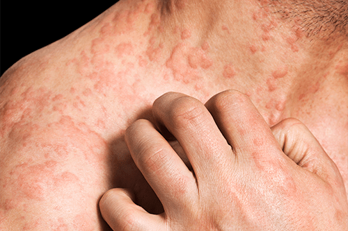 Full Service Allergy Therapy