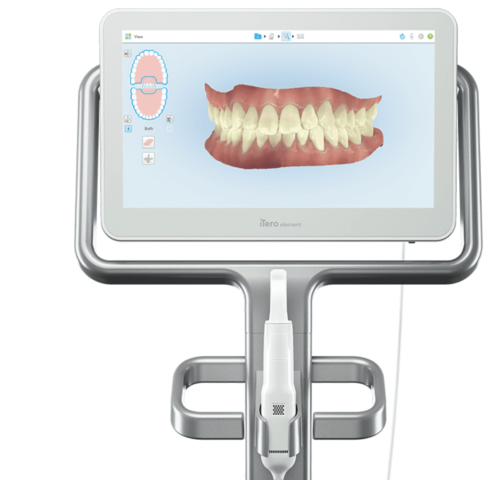 Intraoral scanner
