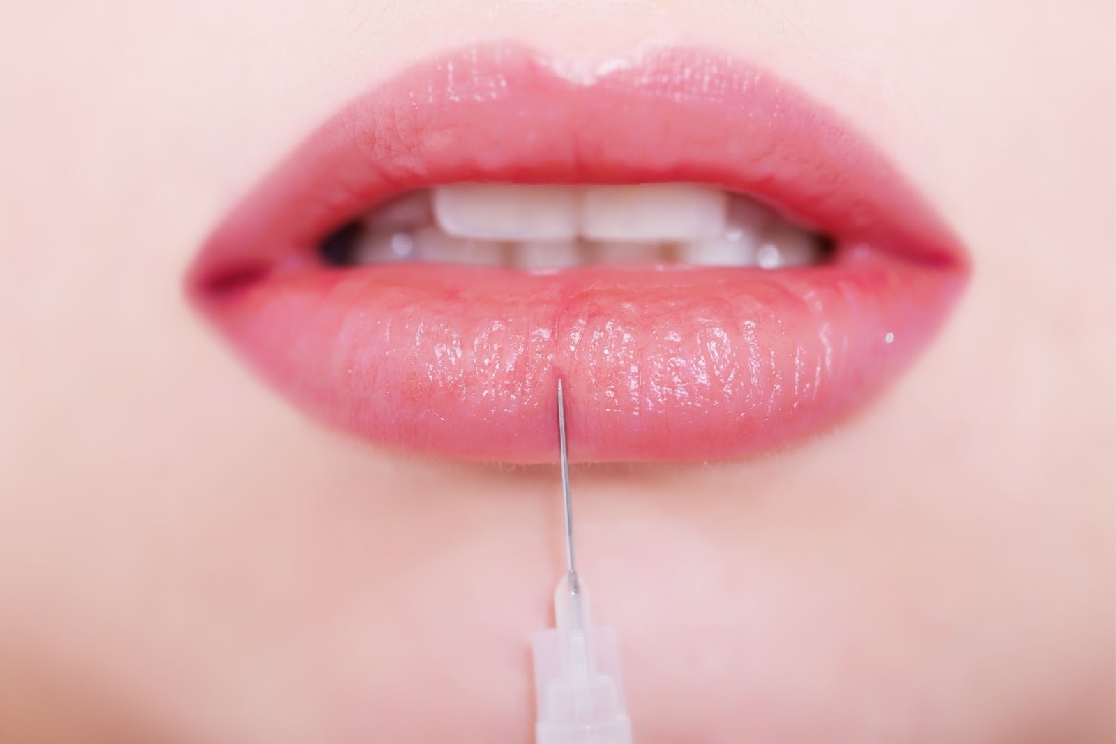 lip injections