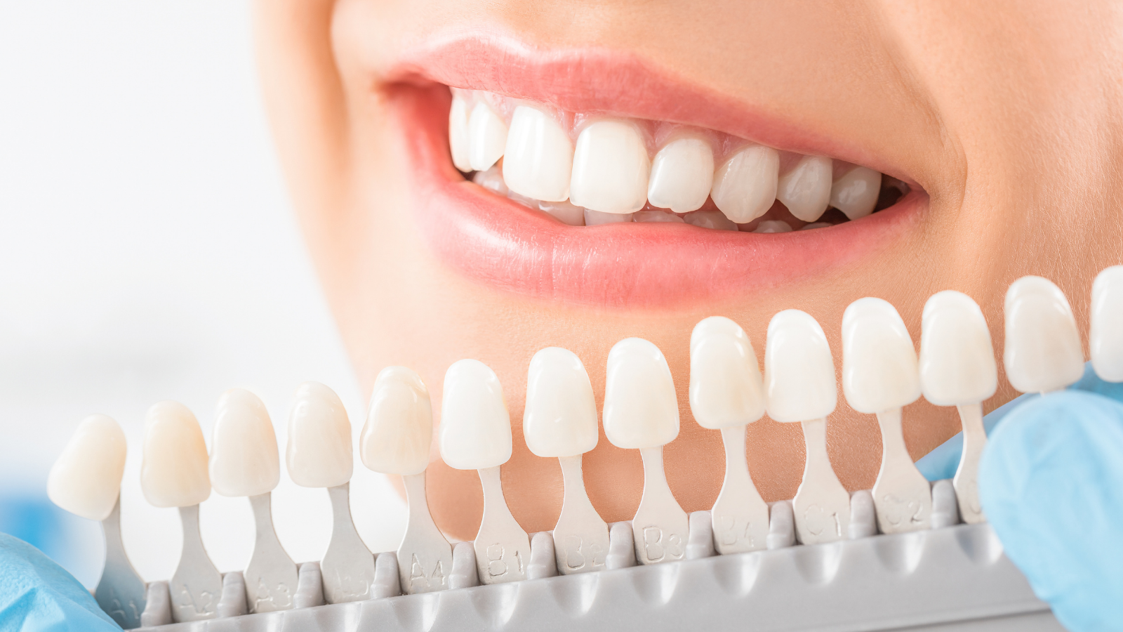 closeup of dentist choosing crown tooth color