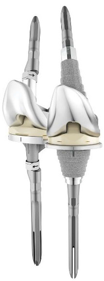 depuy knee revision lawsuit