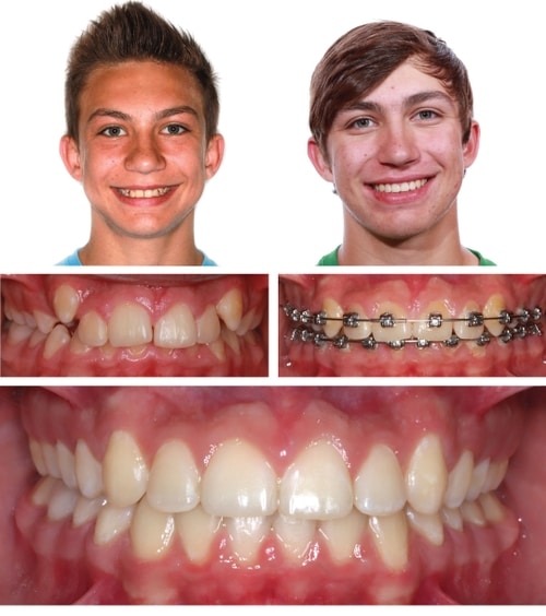 Orthodontics and Pediatric Dentistry Kansas City