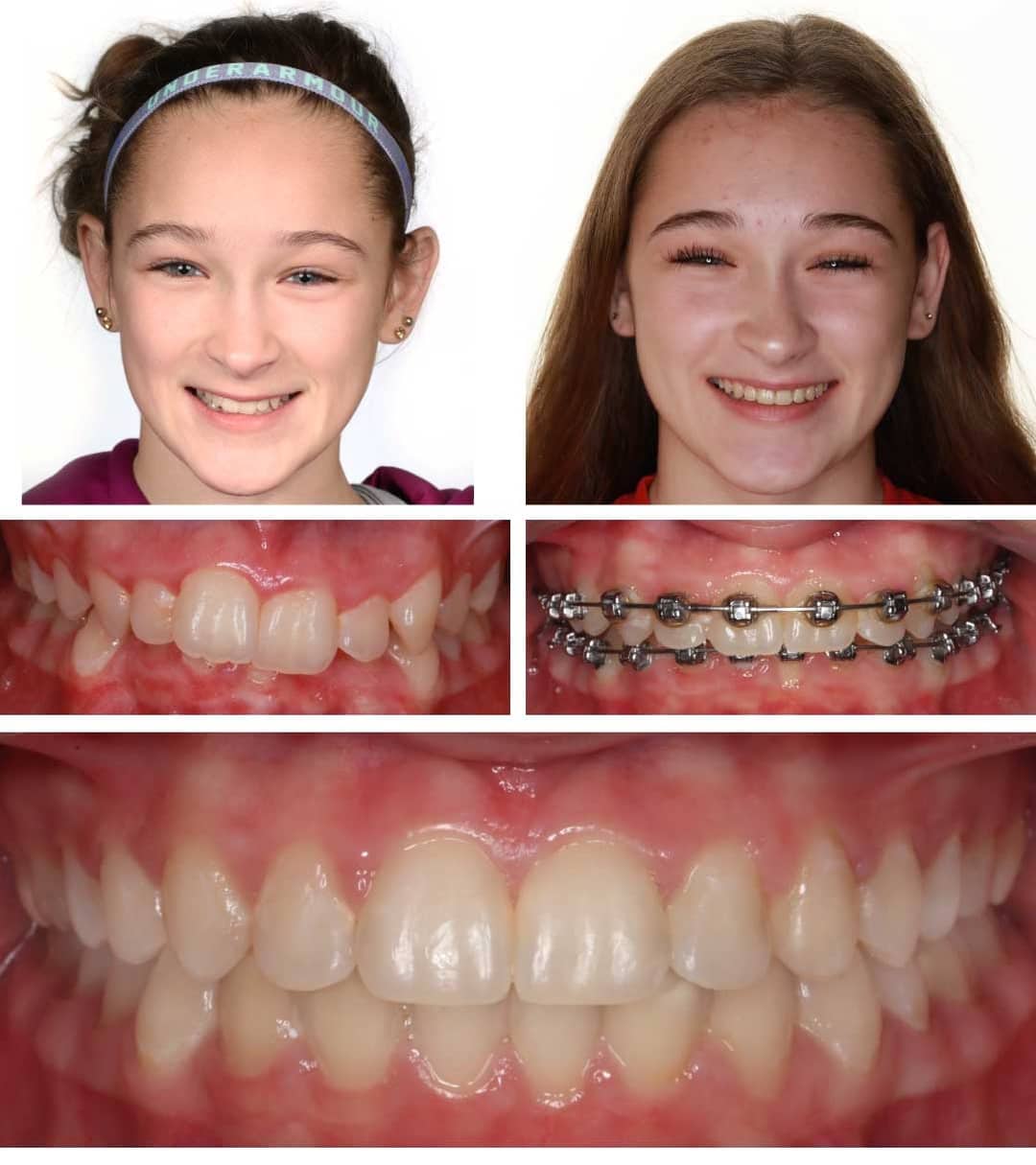 Damon Braces You deserve the best Orthodontics.