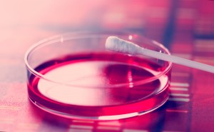 genetic testing