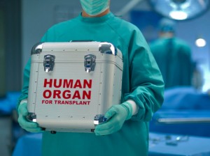 organ transplant