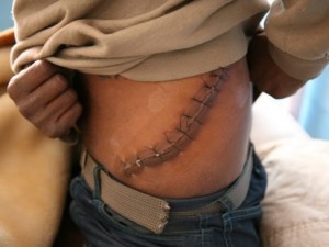 illegal-trade-kidneys-increasing-making-organ-trafficking-industry-even-more-lucrative