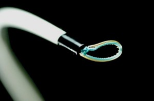 A Lariat device is used to tie the left atrial appendage and eliminate the risk of stroke without the use of blood thinners.