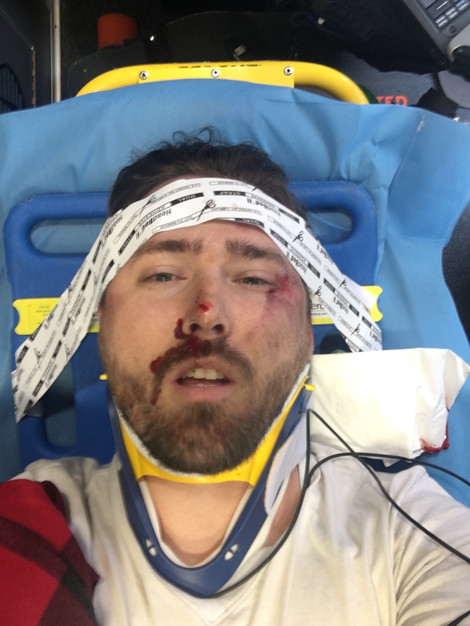 Picture taken by ambulance medic to convince me I had to go to the hospital.