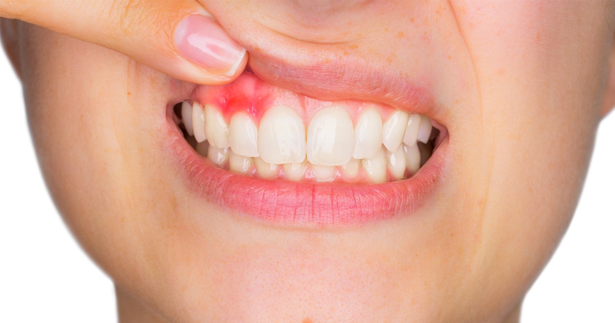 Oral Cancer Detection and Treatment 