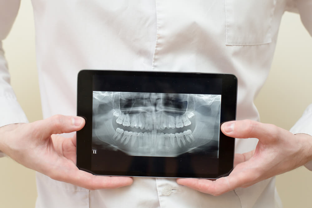Digital XRays Vs. Traditional XRays What’s The Difference? Redmond