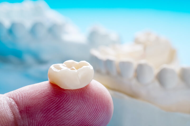 closeup of CEREC machine