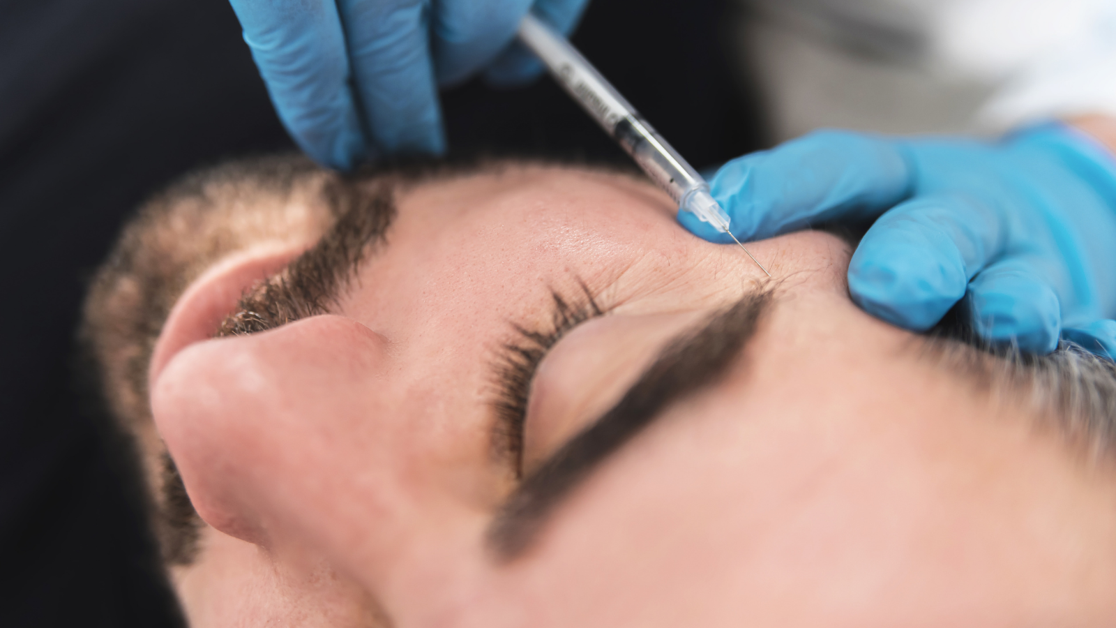 man getting dermal fillers