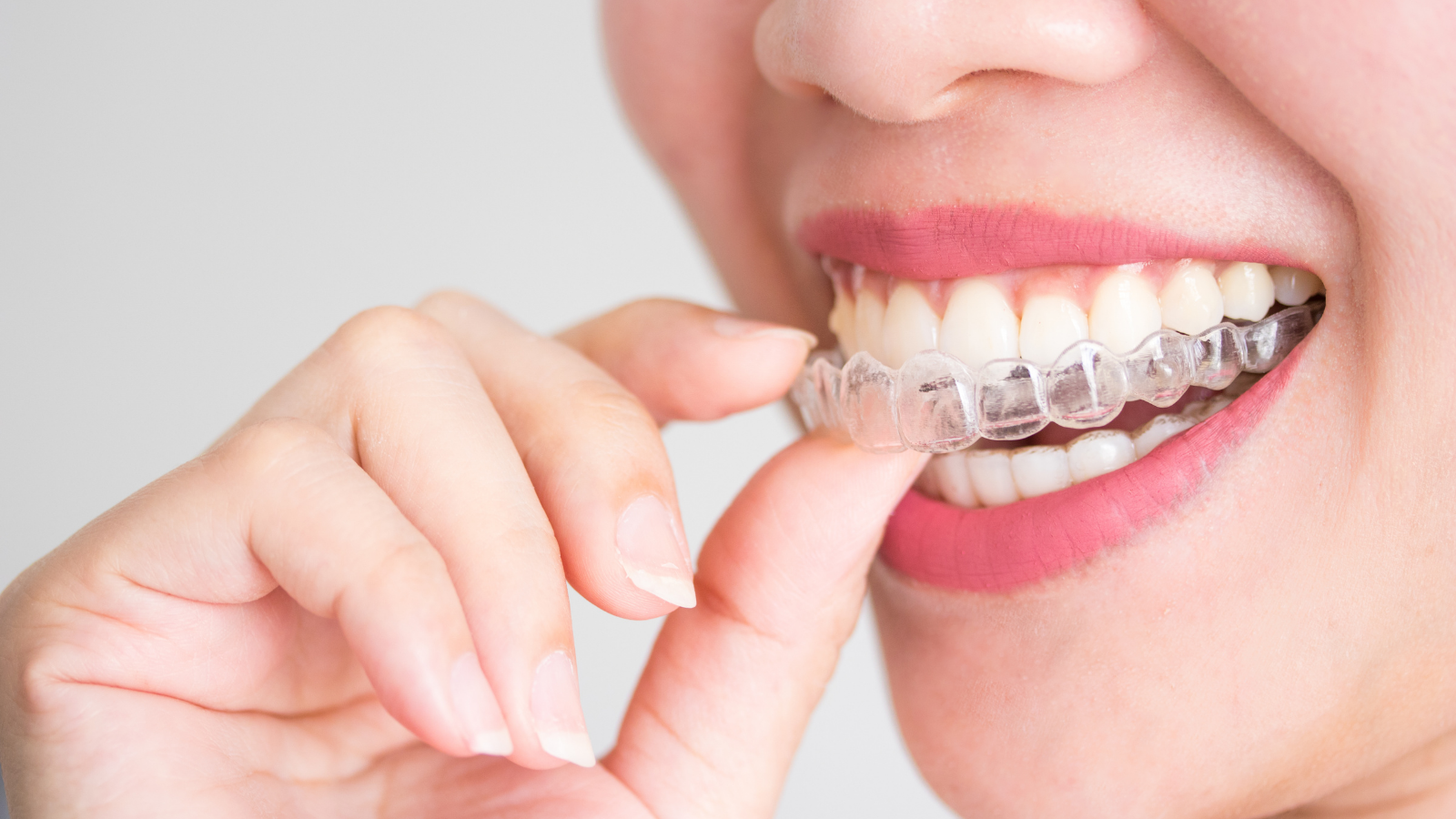 woman putting Invisalign into mouth
