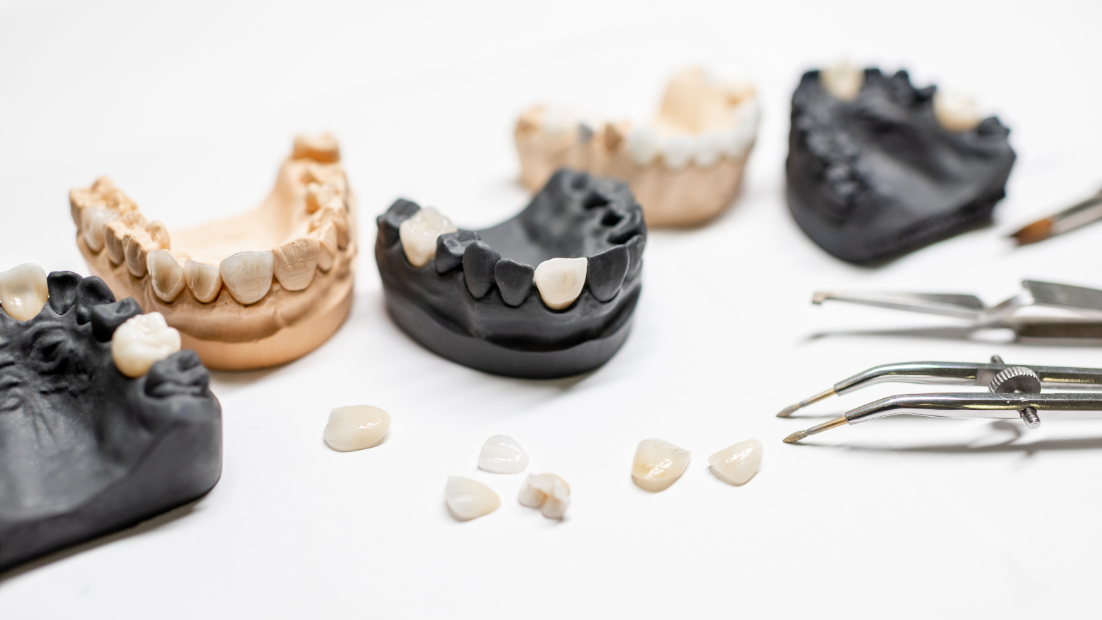 veneers put onto tooth molds