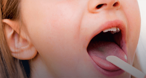 Request an Appointment for your throat issues