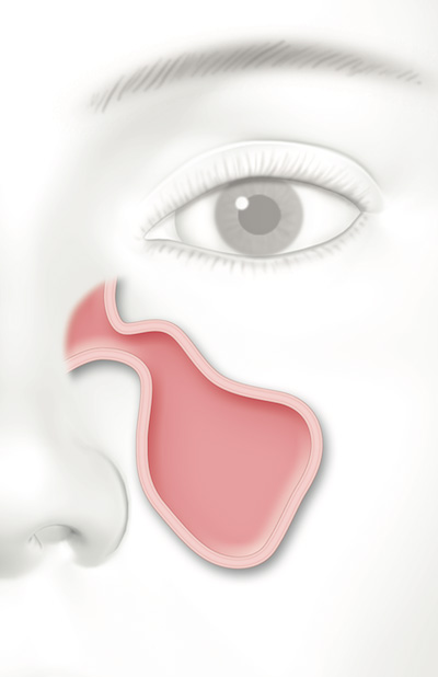Woman-Sinus.jpg
