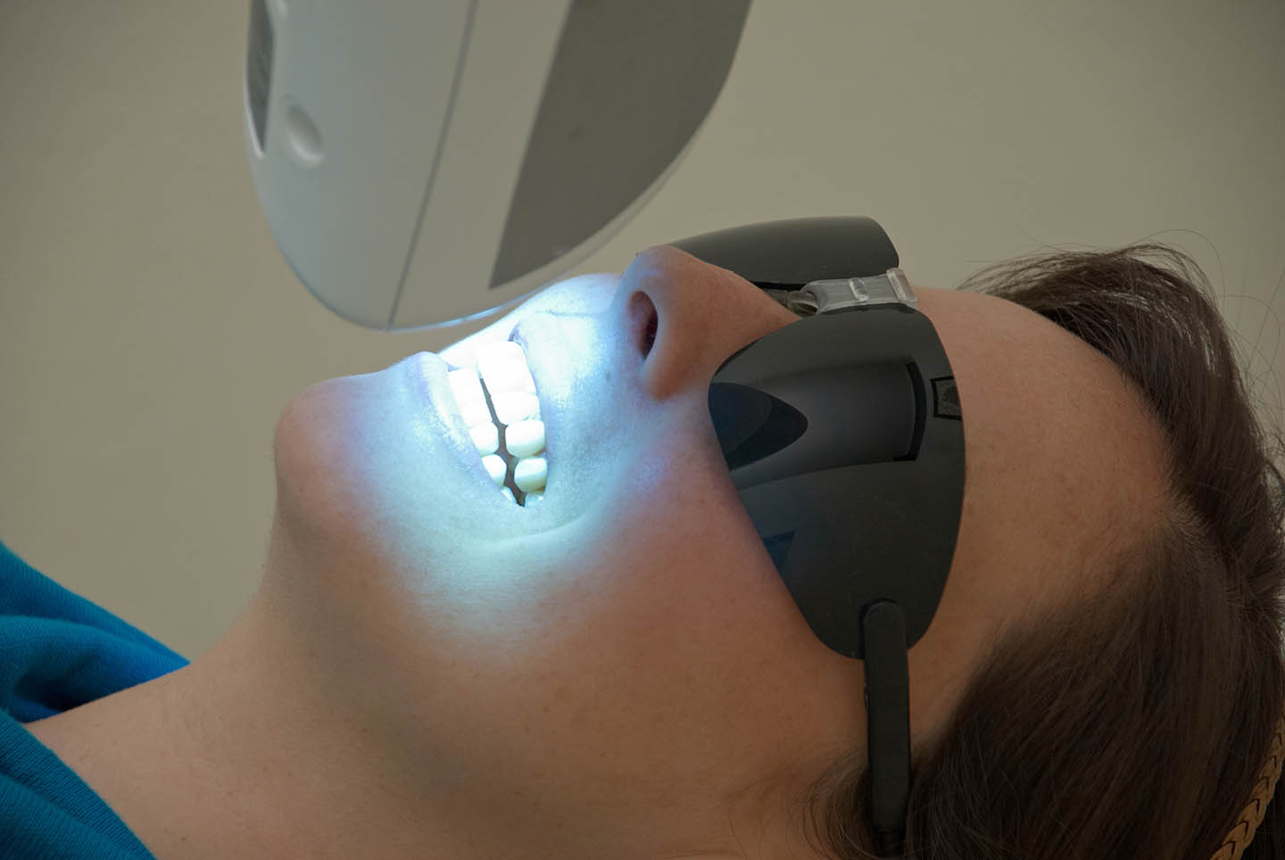 teeth whitening with uv light