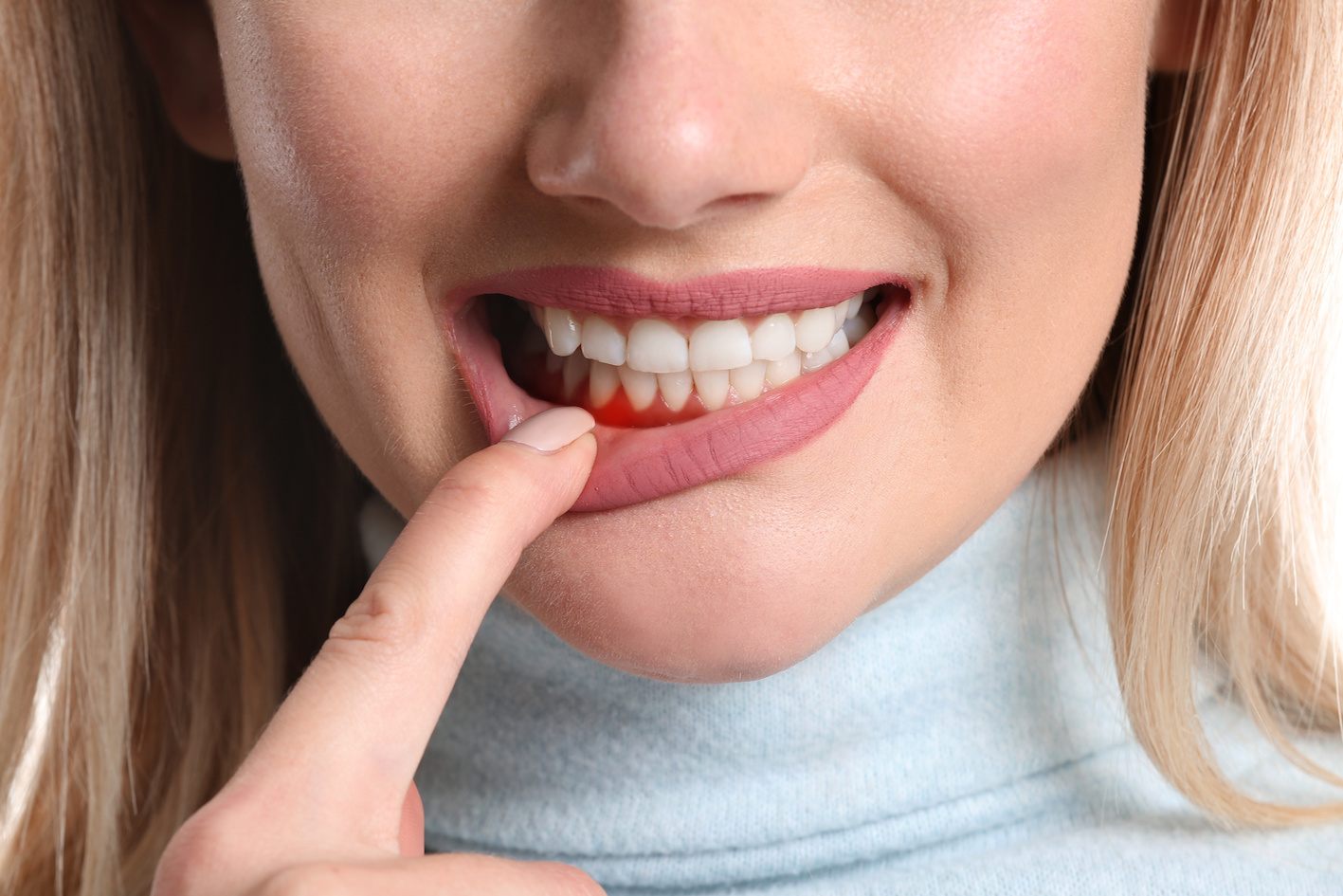 woman pointing at gums