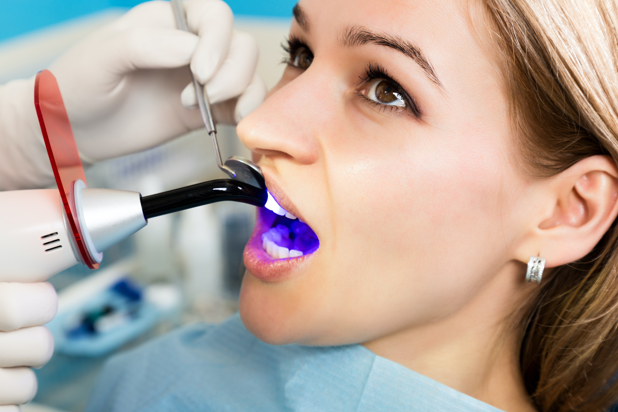 tooth implant