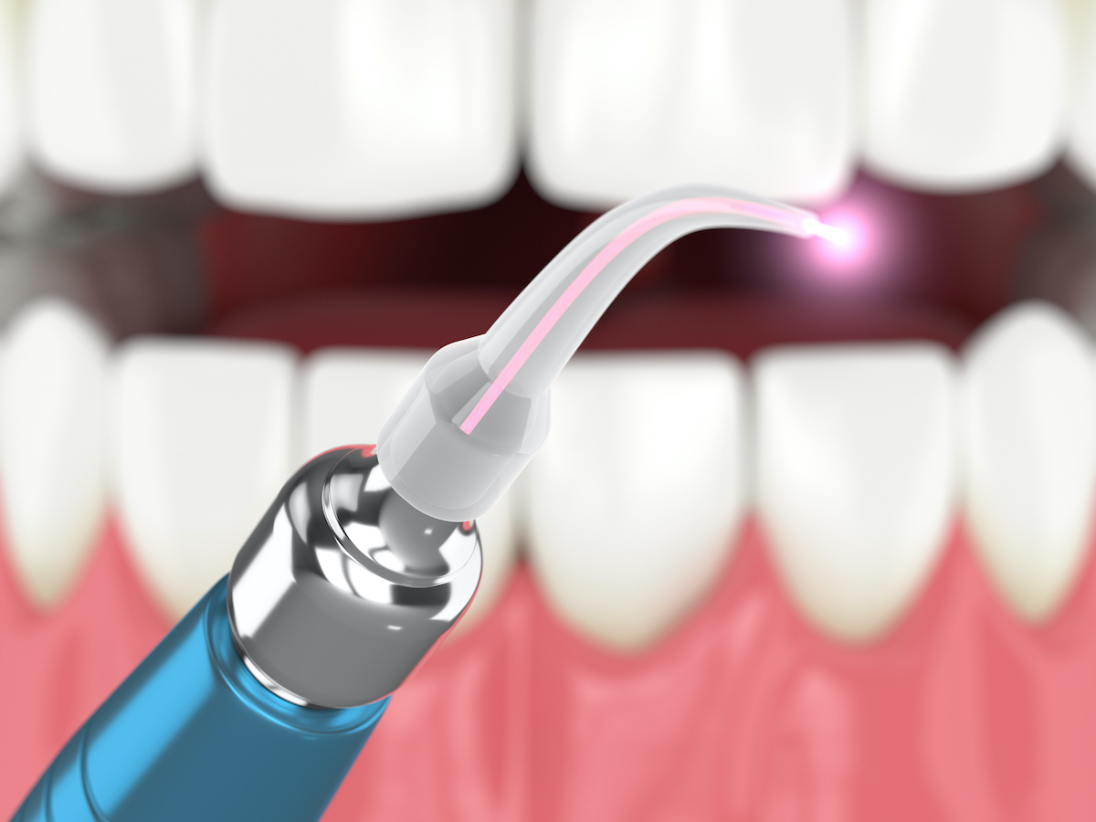 woman holding invisalign