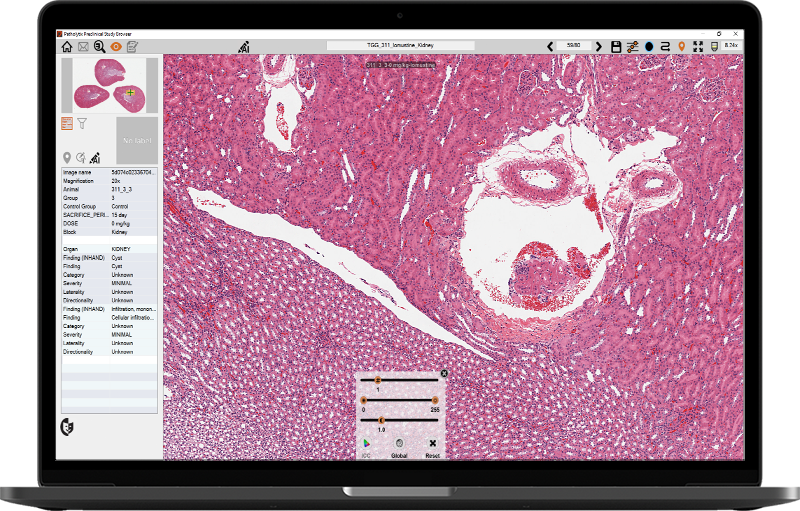 Pathox Patholytix