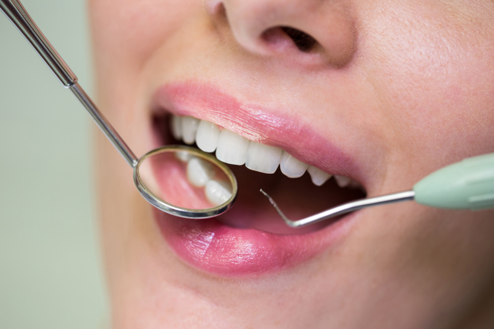 The Importance of Periodontal Maintenance for Optimal Oral Health