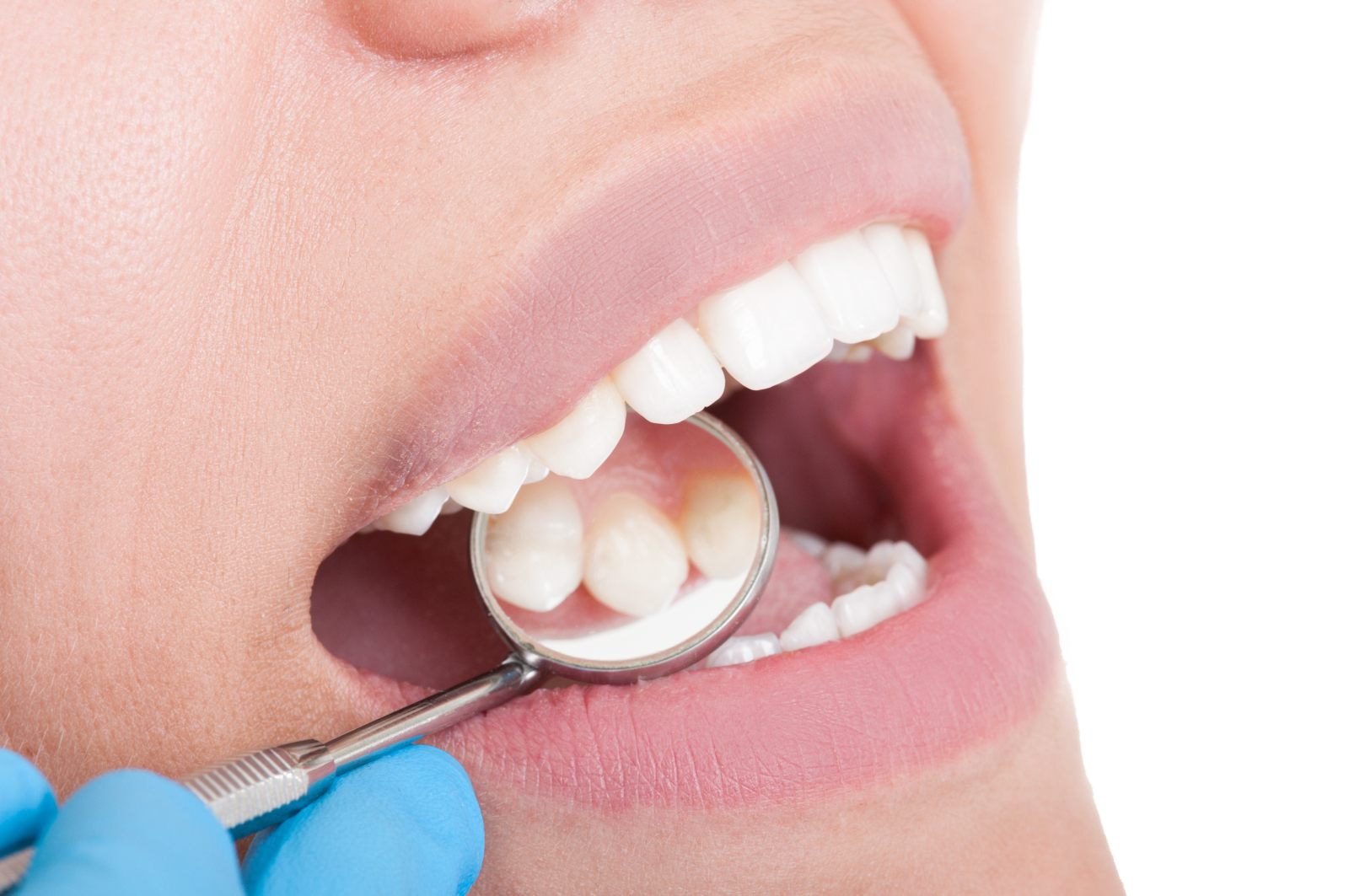 dentist checking out patient's mouth and teeth