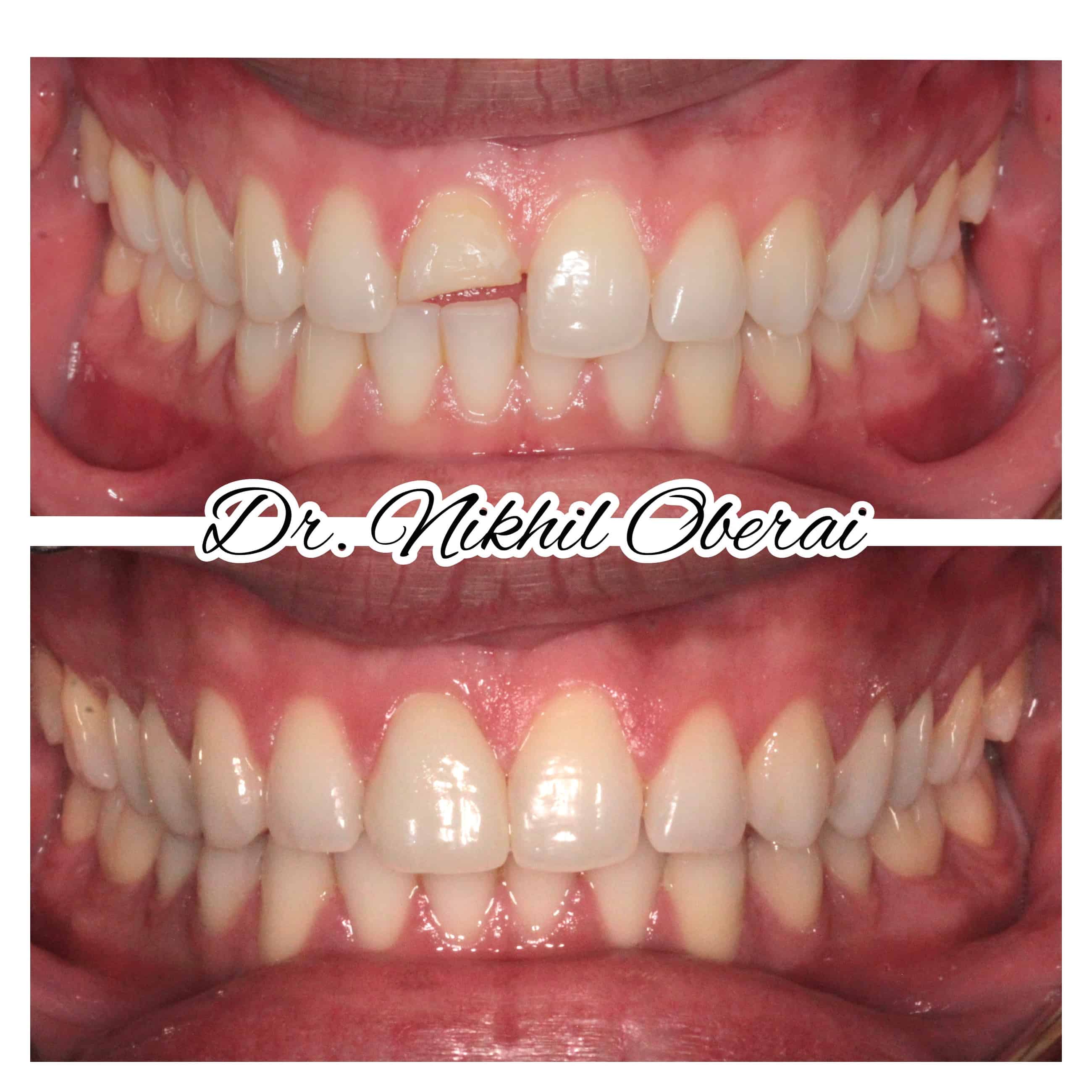 Smile Gallery Brunner Court Dental & Implant Practice