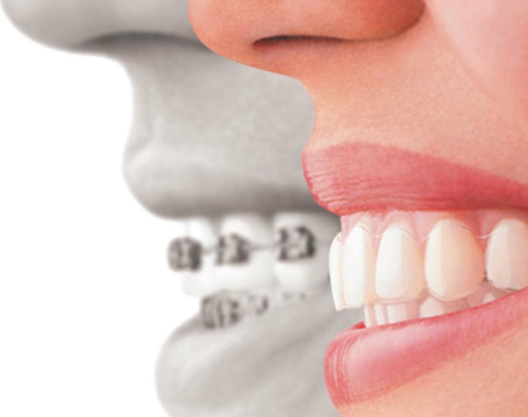 Campbell Orthodontics Kandoo