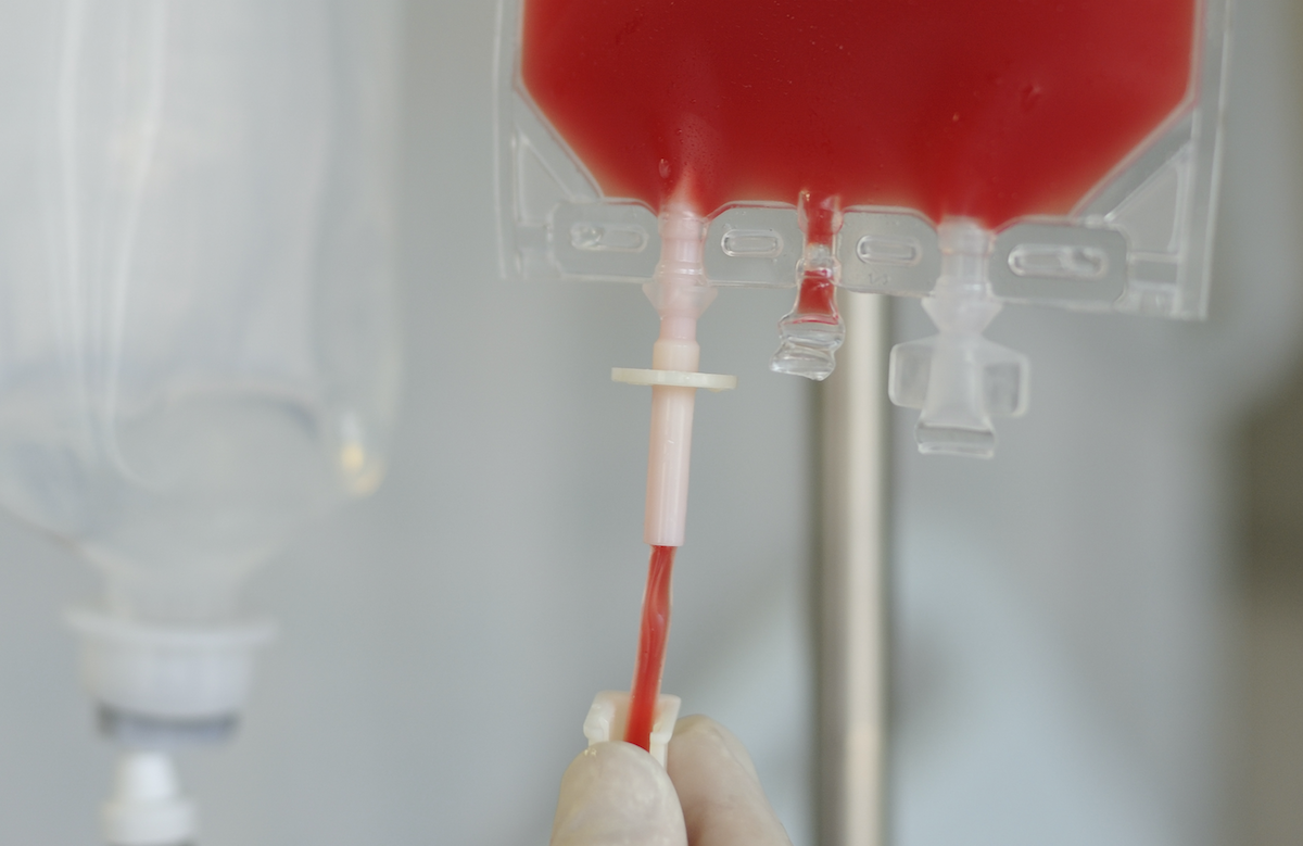 New Study Co-Authored by InsightRX Shows Model-Informed Precision Dosing Could Improve Efficacy of Hematopoietic Cell Transplants While Reducing Toxicity