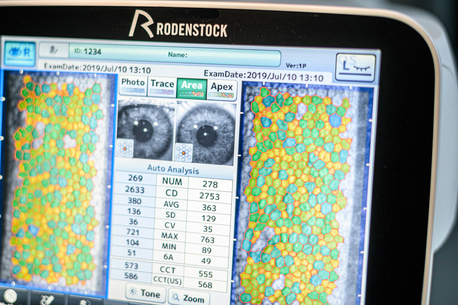 Diagnostic Specular Microscope REM 4000