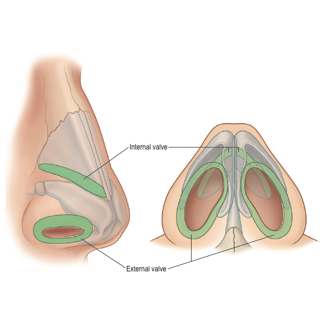 Patients choose rhinoplasty for improved appearance or nasal function