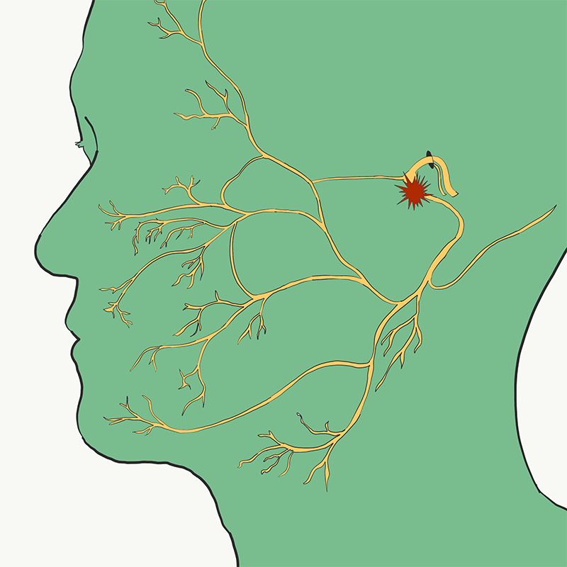 Facial Nerve Diagram